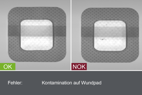 Industrial camera image of the inspection of plasters in the production process - contamination on wound pad - with good and bad image