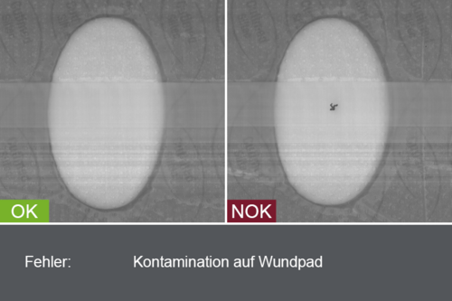 Industrial camera image of the inspection of plasters in the production process - product shape and size - with good and bad image