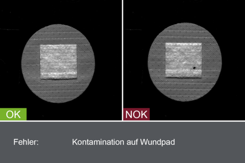 Industrielles Kamerabild von der Inspektion von Pflastern im Produktionsprozess - Kontamination auf Wundpad - mit Gut- und Schlechtbild