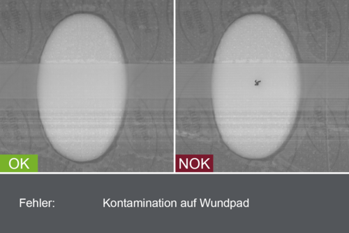 Industrielles Kamerabild von der Inspektion von Pflastern im Produktionsprozess - Kontamination auf Wundpad - mit Gut- und Schlechtbild